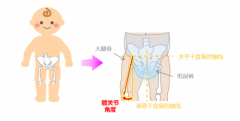 穿着纸尿裤对幼儿步行影响的因素解析